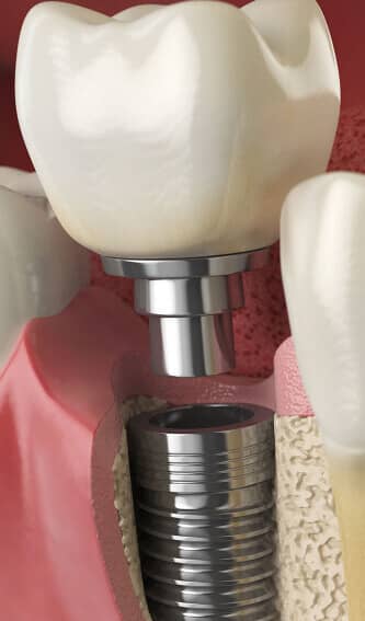 orthodontics
